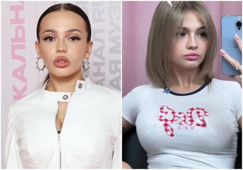 Валя Карнавал до пластики: как выглядела Валя Карнавал до пластической операции, фото