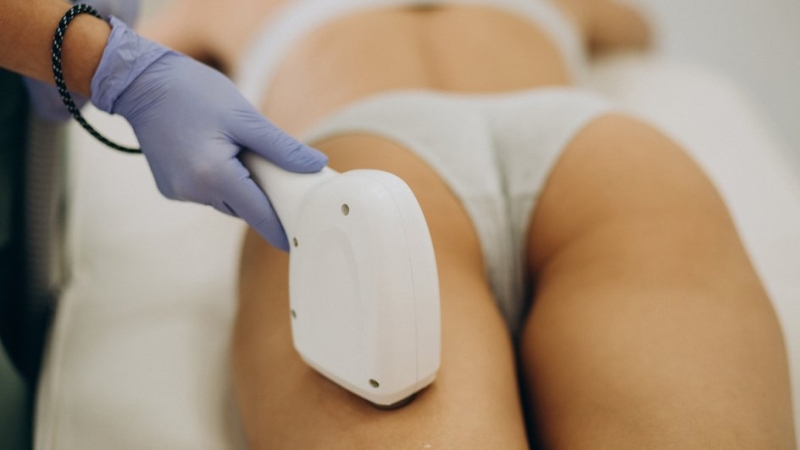 Лазерная эпиляция на разных участках тела: нюансы проведения процедуры на ногах, руках, зоне бикини, лице