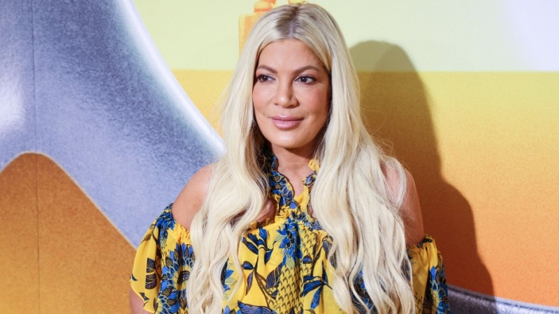 Звезды, у которых начались проблемы со здоровьем из-за пластики: фото