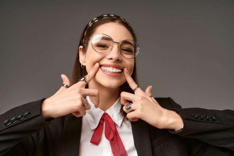 Мифы о брекетах: что такое элайнеры, можно ли ставить брекеты после 50, нужна ли диета с брекетами, рекомендации врача