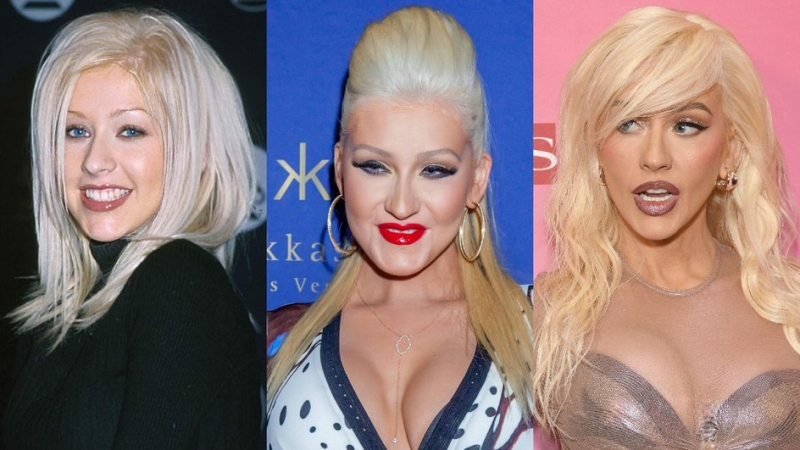 Как менялись губы Кайли Дженнер, Маши Малиновской, Меган Фокс и других звезд