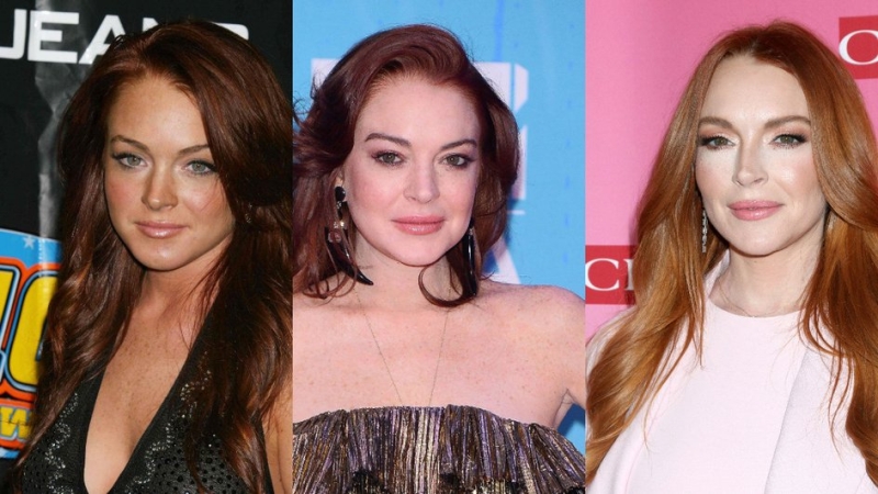 Как менялись губы Кайли Дженнер, Маши Малиновской, Меган Фокс и других звезд