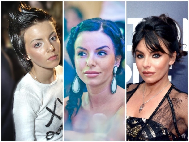 Как менялись губы Кайли Дженнер, Маши Малиновской, Меган Фокс и других звезд