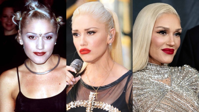 Как менялись губы Кайли Дженнер, Маши Малиновской, Меган Фокс и других звезд