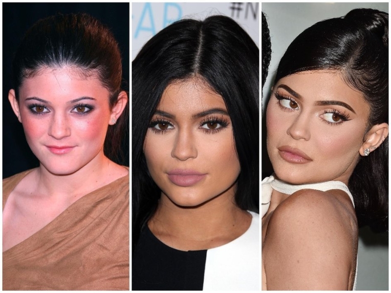 Как менялись губы Кайли Дженнер, Маши Малиновской, Меган Фокс и других звезд