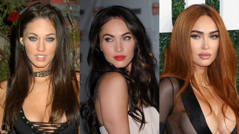 Как менялись губы Кайли Дженнер, Маши Малиновской, Меган Фокс и других звезд