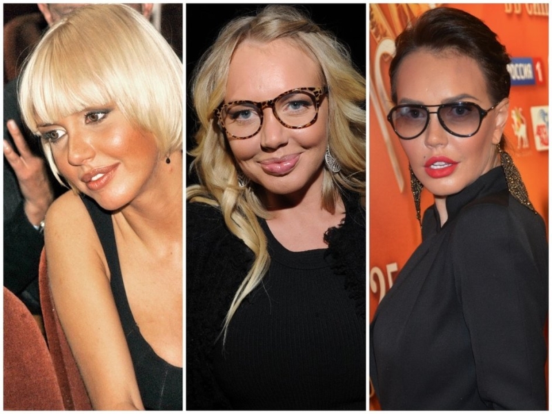 Как менялись губы Кайли Дженнер, Маши Малиновской, Меган Фокс и других звезд